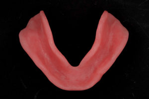 Mold of Removable Complete Dentures