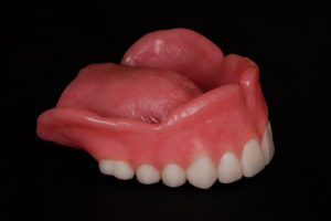 Mold of Removable Complete Dentures top