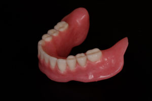 Mold of Removable Complete Dentures bottom